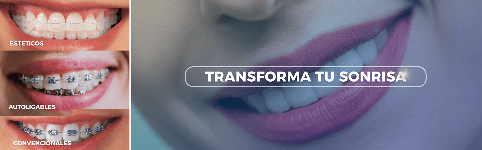 ORTODONCIA AREQUIPA SPA ODONTOLOGICO INTERNACIONAL CLINICA DENTAL