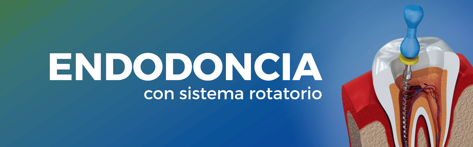 CLINICA DENTAL AREQUIPA ENDODONCIA