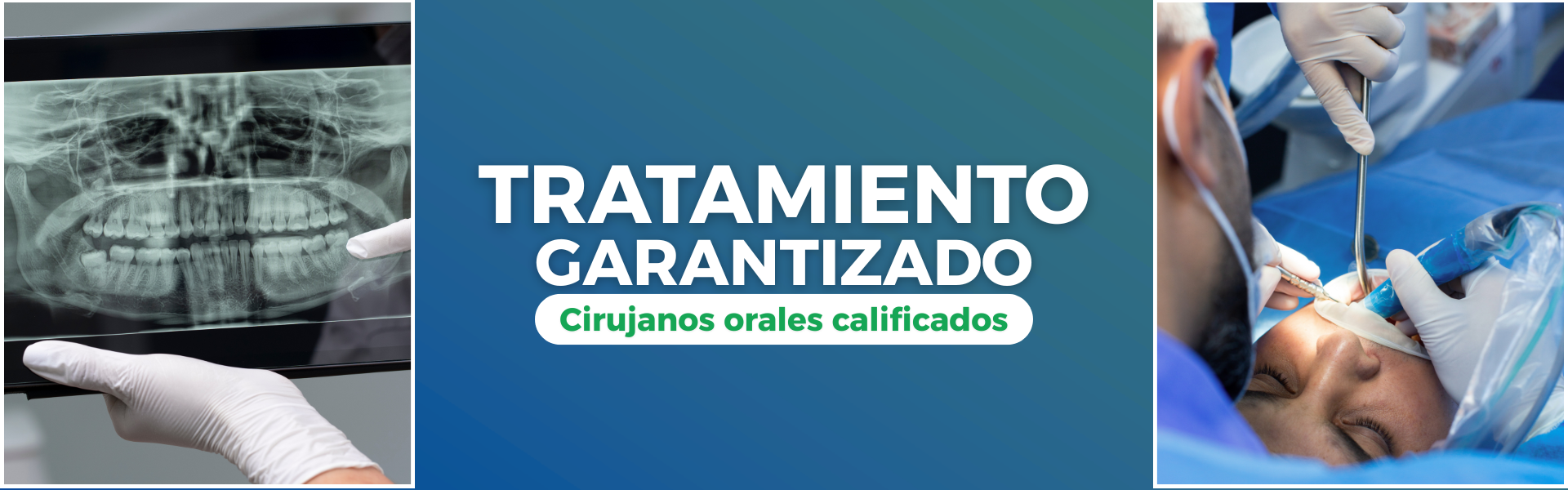 cirugía oral spa odontológico internacional