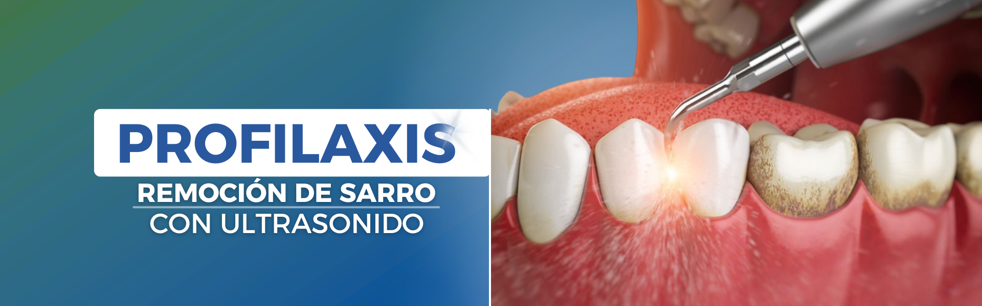 PROFILAXIS SPA ODONTOLOGICO INTERNACIONAL
