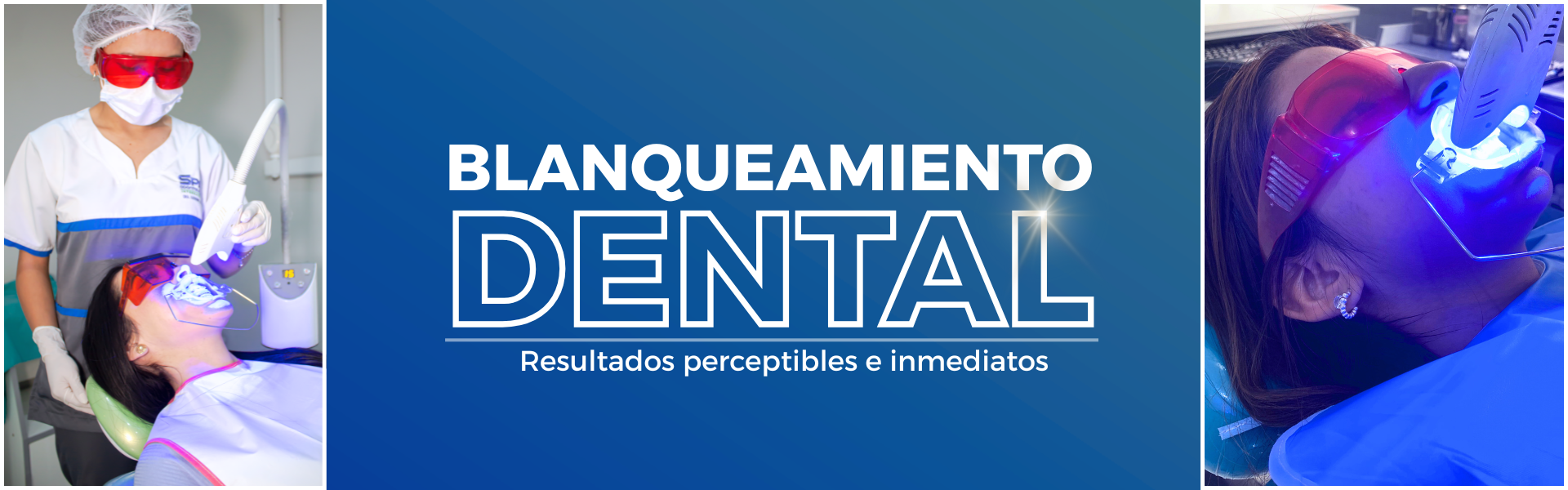 BLANQUEAMIENTO DENTAL SPA ODONTOLOGICO INTERNACIONAL