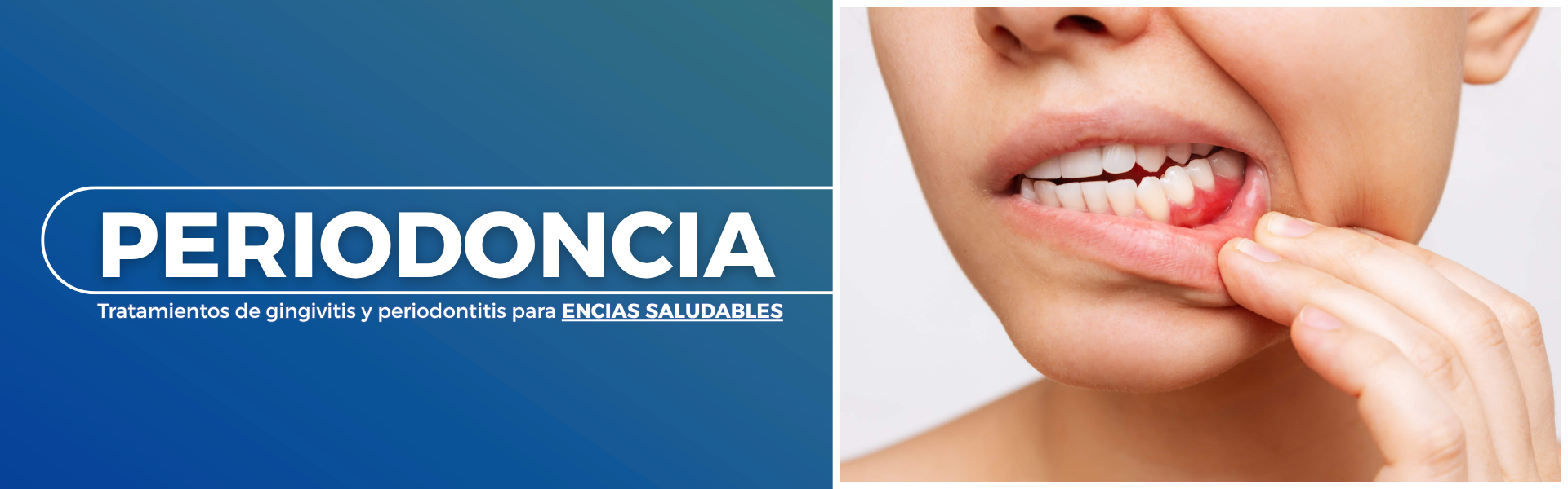 periodoncia spa odontologico internacional
