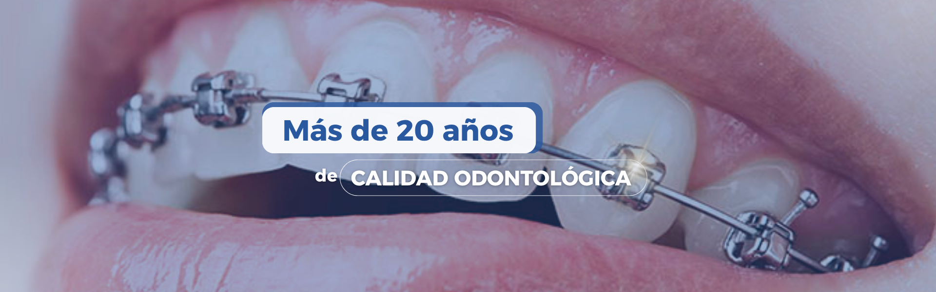 spa odontológico internacional Arequipa