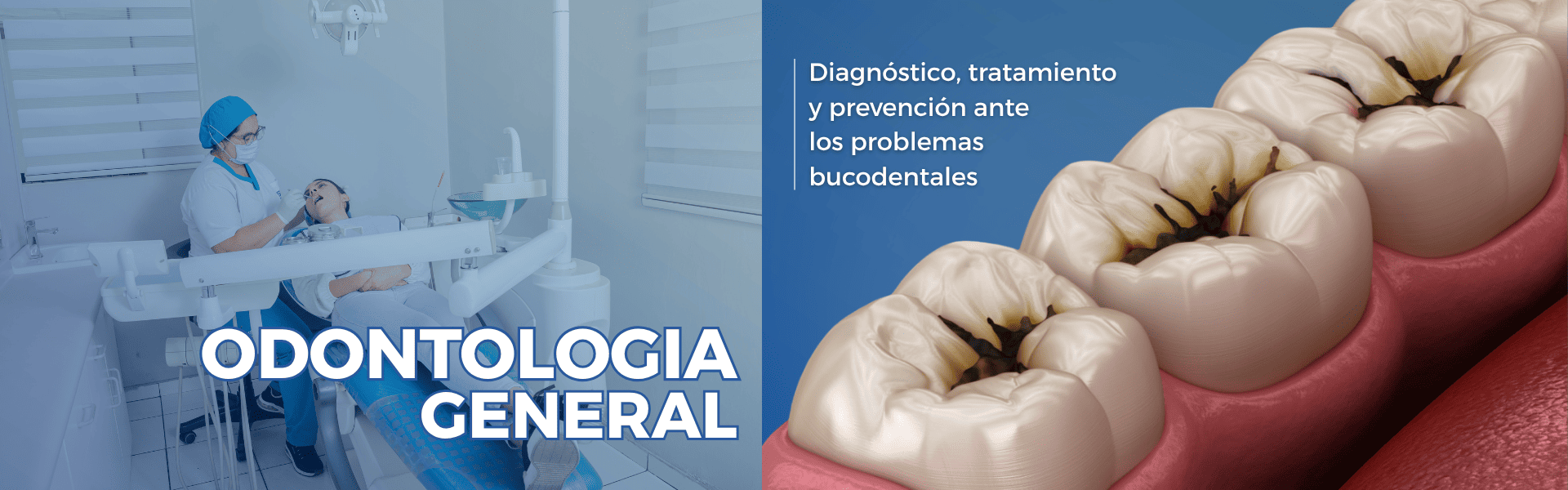 spa odontológico internacional odontologia general arequipa